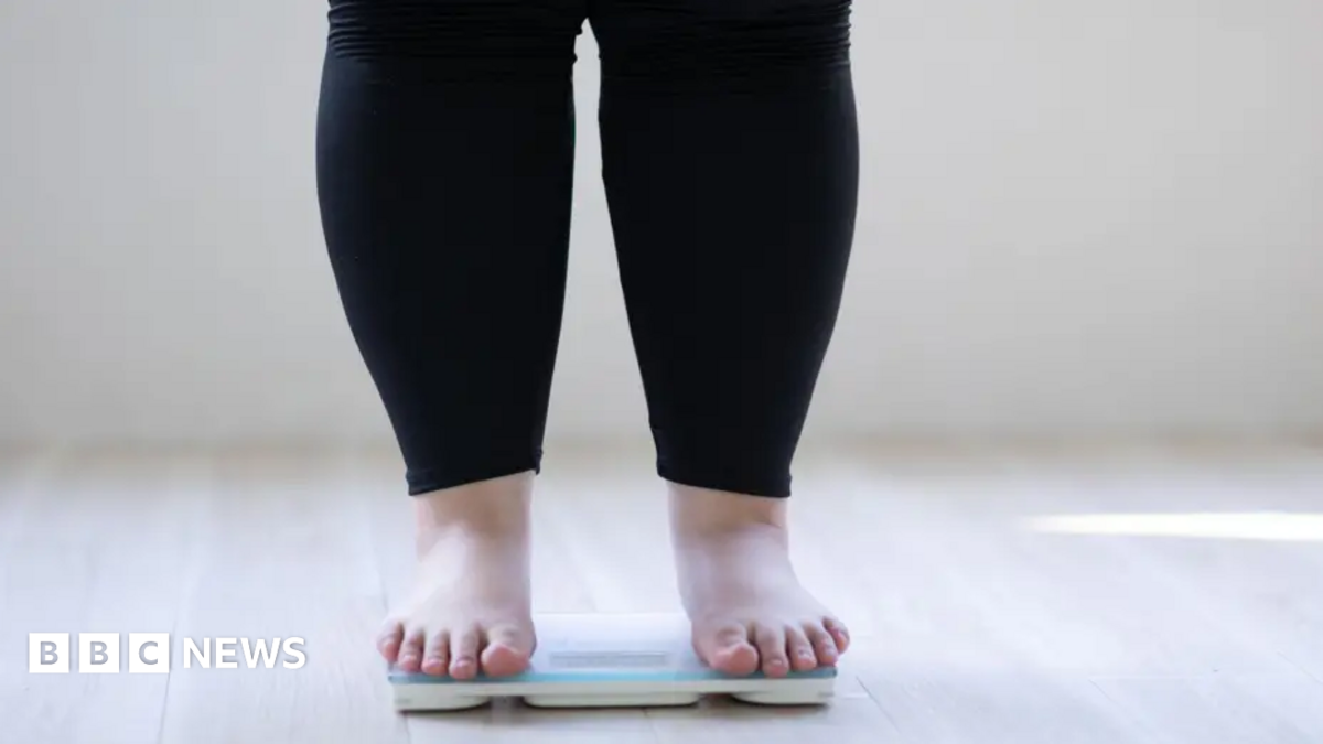 Obesity cases rising fastest in young adults
