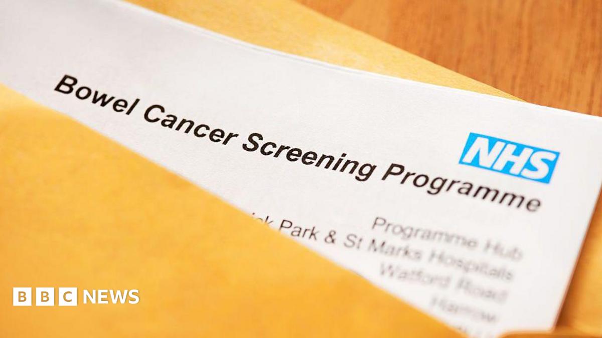 People in 50s urged to complete bowel cancer screening