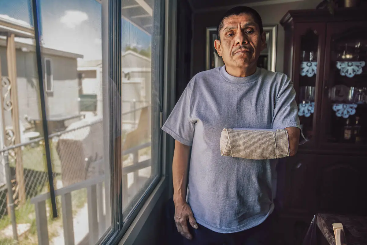 Man copes with loss of hand after Las Vegas crash involving suspected DUI driver
