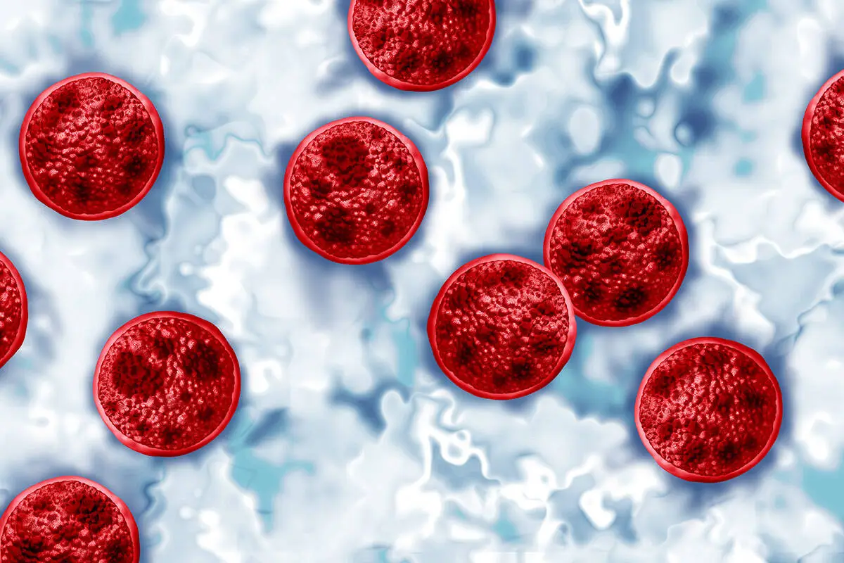Health District reports potentially domestically acquired case of cyclosporiasis